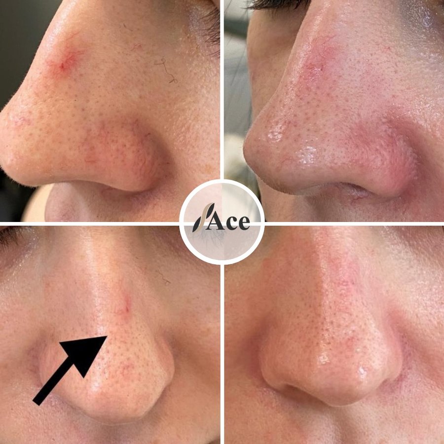 Ace Aesthetics - Ace Aesthetics